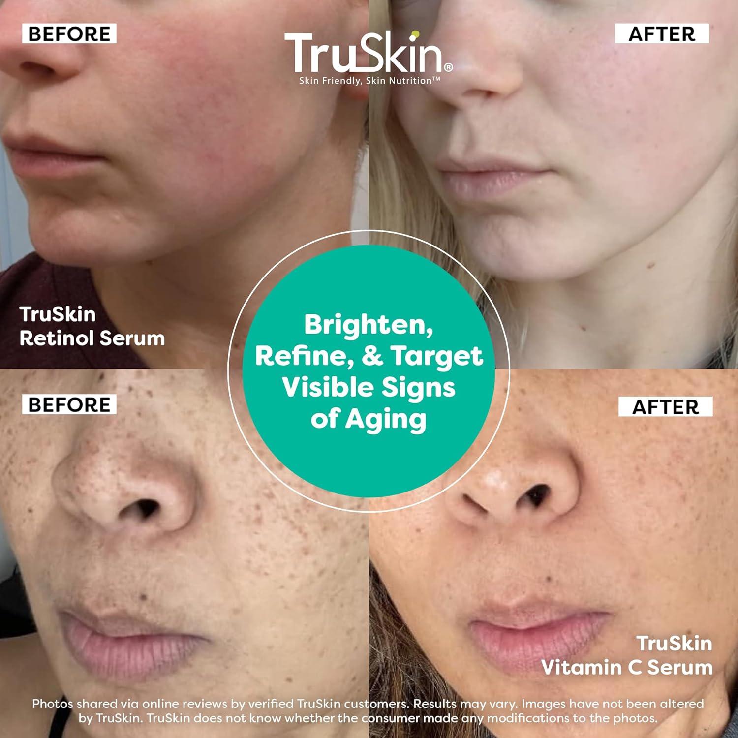 image:imageTruSkin Face Serum Duo Vitamin C Serum amp Retinol Serum for Face AM amp PM Anti Aging Skincare Routine Brightening amp Smoothing Facial Serums 1 fl oz Each